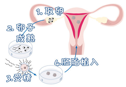 42岁成功案例